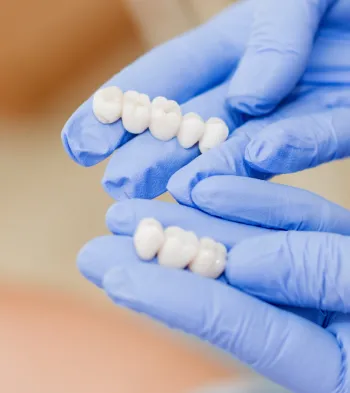 Dental Crowns at Southern Prosthodontics in North, MS